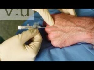  (v)-Proper technique for IV injections
